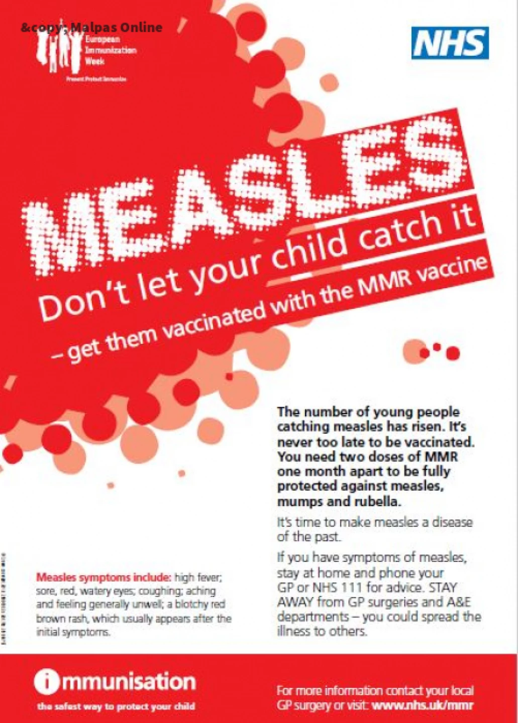 measles